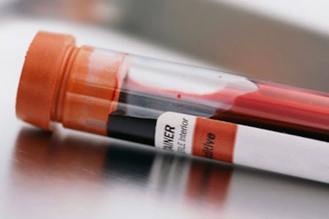 Renewed call to scrap gay blood ban