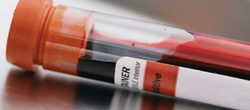 Students call to end gay blood ban in Australia