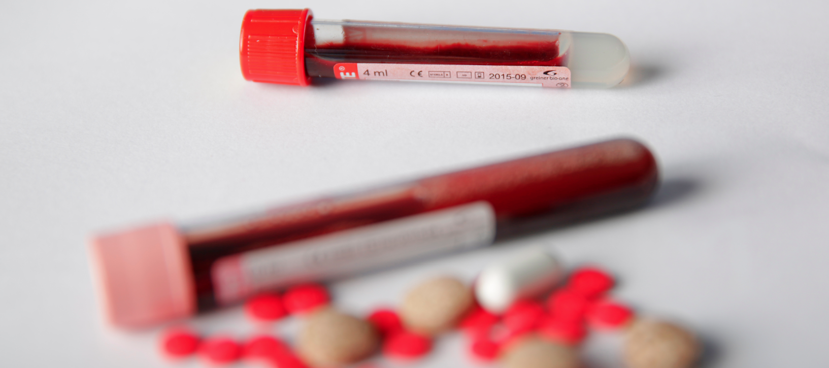 Experts Say SA’s New Mandatory Blood Testing Bill Perpetuates Stigma Of HIV