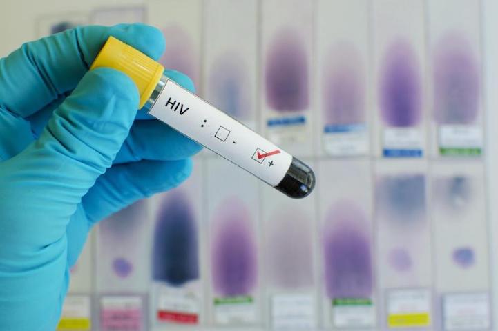 Gaps in HIV diagnosis and treatment for women and migrants