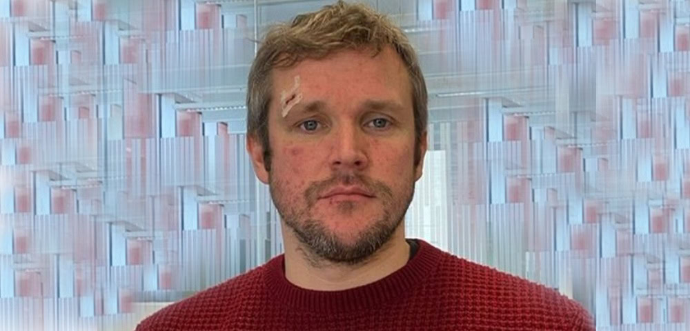 Another Homophobic Attack In UK, Victim Hit With Bottle For Holding Hands With Another Man