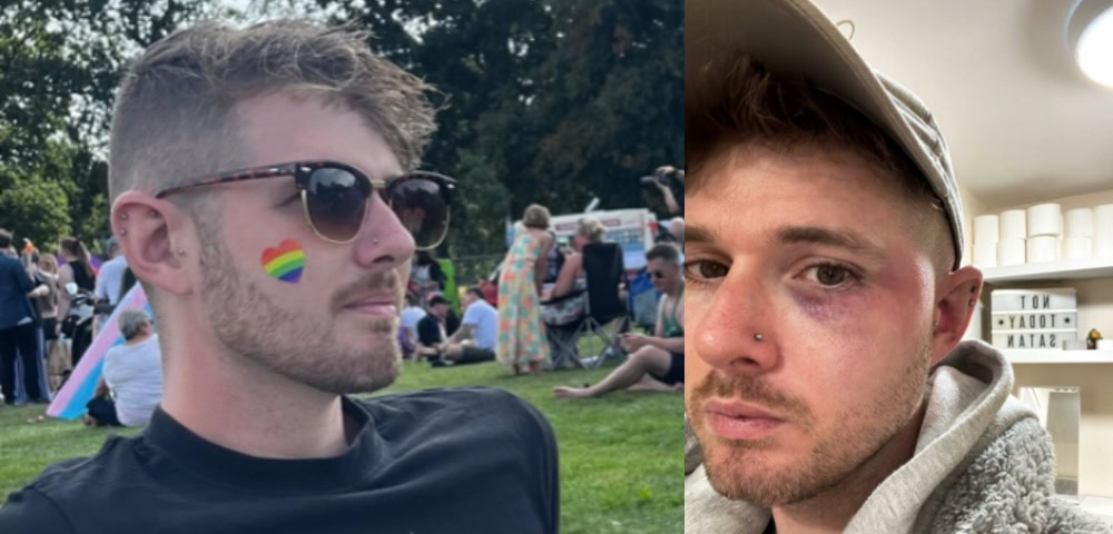 Gay Man Assaulted In Vicious Homophobic Attack In UK