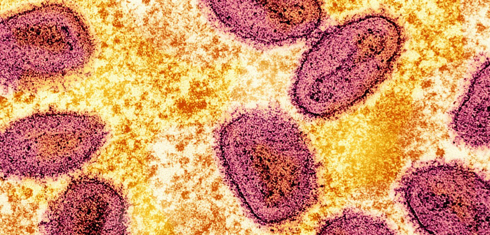 ‘Limit Sexual Partners’ To Reduce Mpox Transmission, Says Chief Health Officer