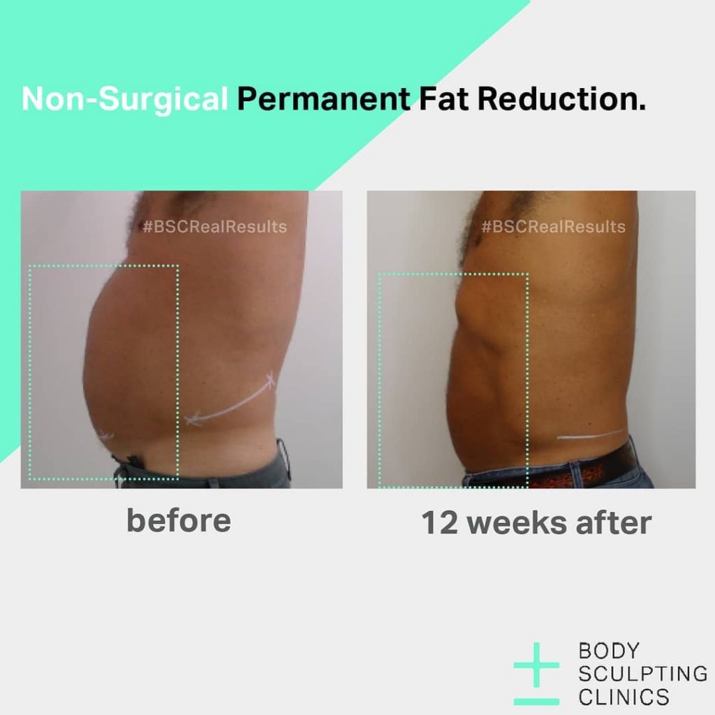body sculpting clinics