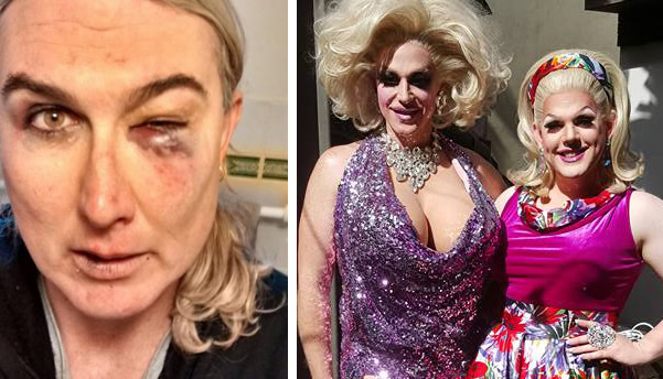 Assault victim slams ‘poor taste’ Anzac Day event