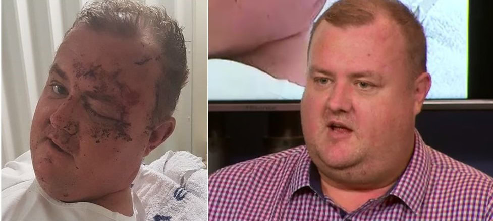 Police seek witnesses to homophobic bashing in Melbourne