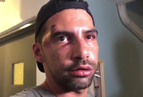 Police called out for indifferent response to alleged homophobic bashing at Miami Pride