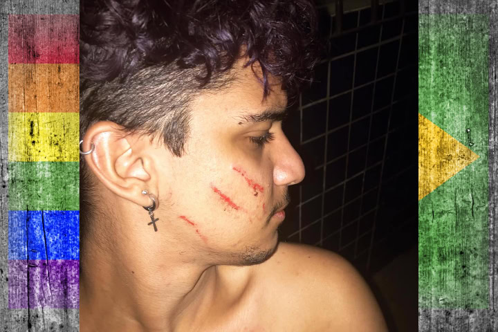 Brazilian Brutalised In Broomstick Beating
