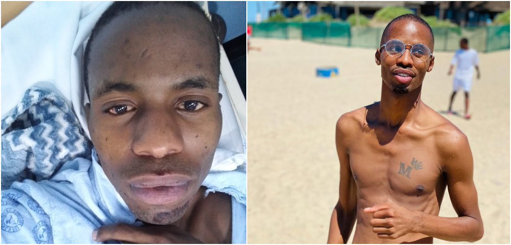 Gay Man Bashed In South Africa